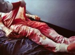 Thumbnail image: Stephanie Sinclair<br>Nurses change the dressings of the badly burned Rokhshana. The Afghan independent Human Rights Commission investigated her situation, but it was sadly too late, 2003-2005