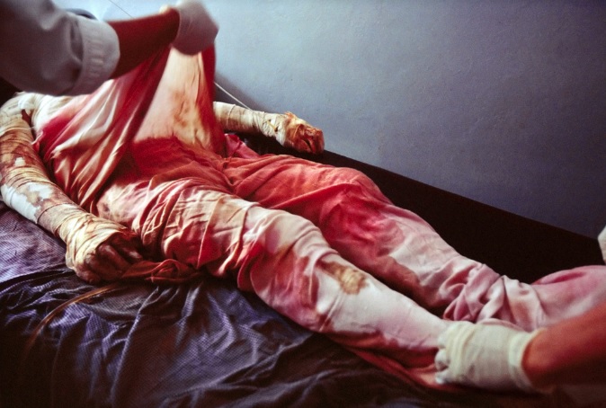 Stephanie Sinclair<br>Nurses change the dressings of the badly burned Rokhshana. The Afghan independent Human Rights Commission investigated her situation, but it was sadly too late, 2003-2005